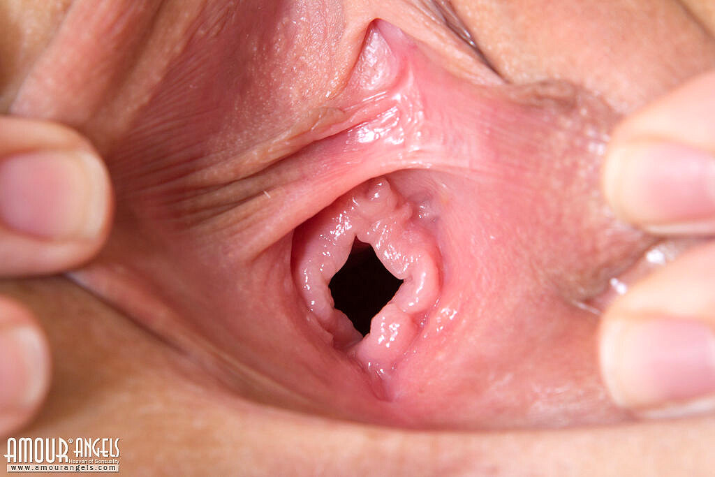 Pic close up vagina virgin