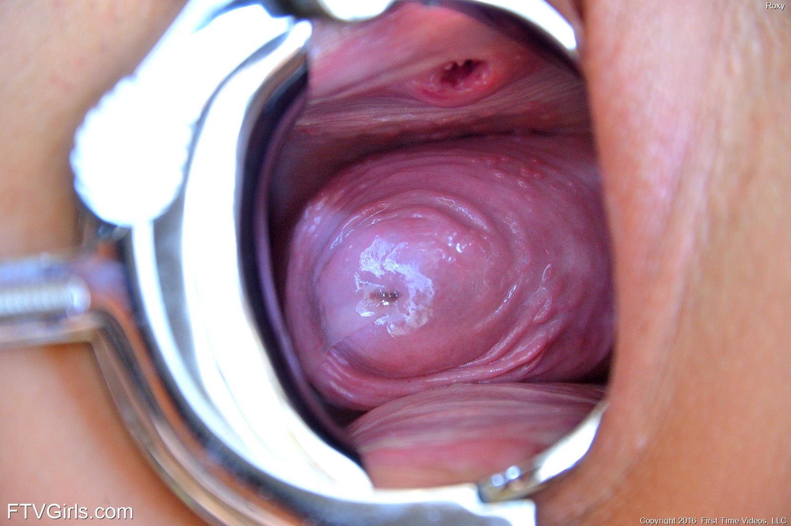 Speculum vaginal close vagina cervix pictures